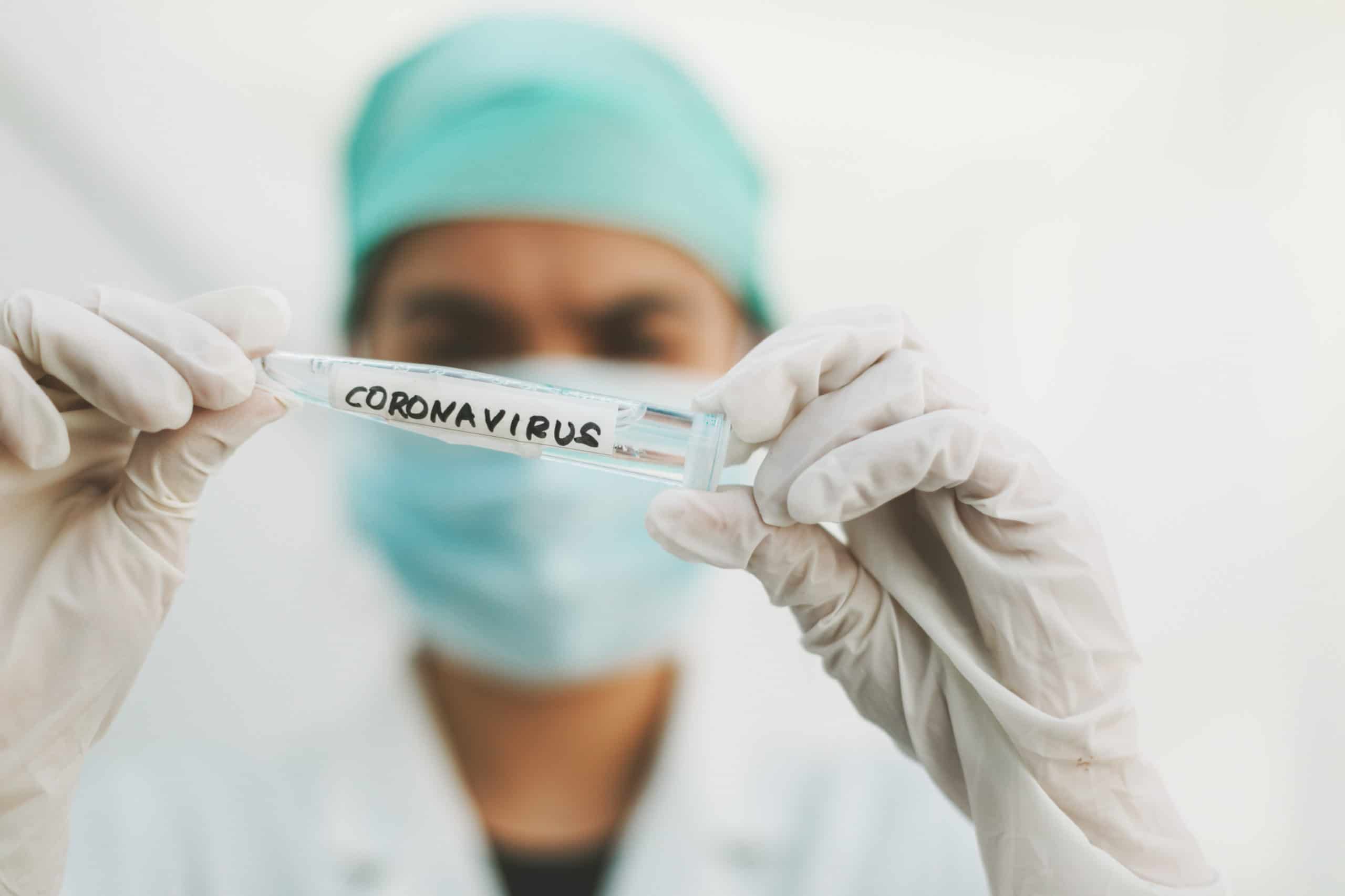 Coronavirus blood test in hospital laboratory