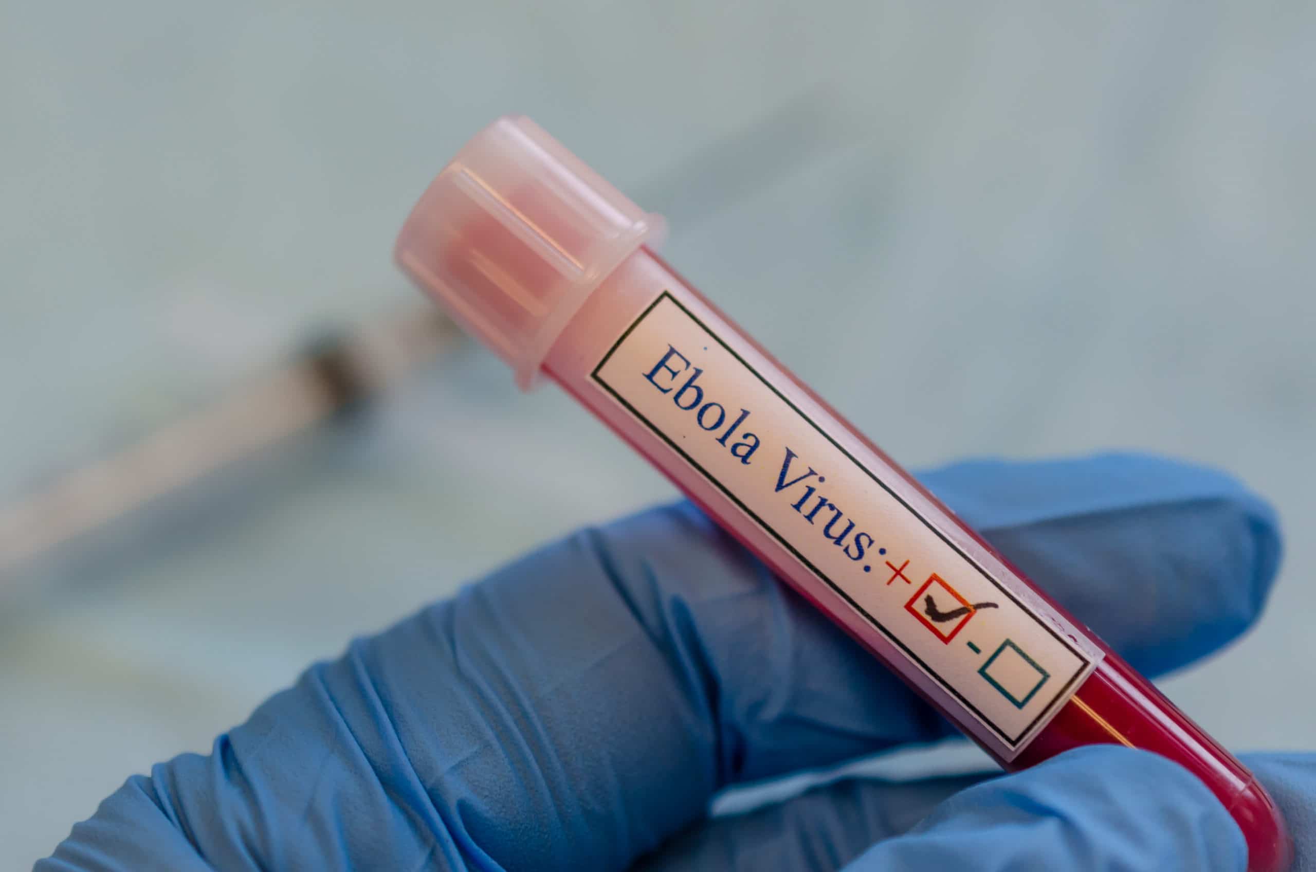 Ebola virus positive blood sample