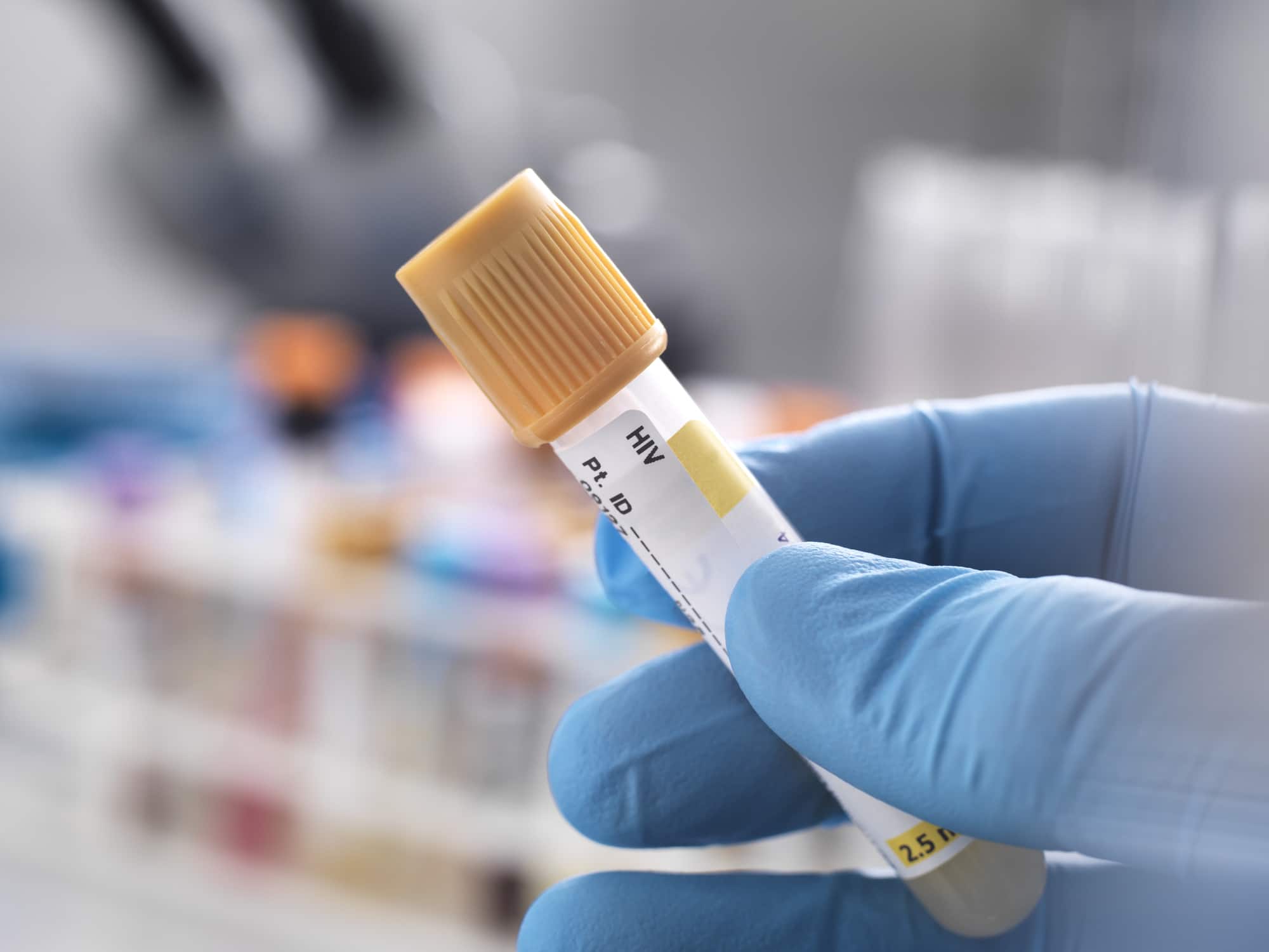 Medical technician preparing a human sample for HIV testing
