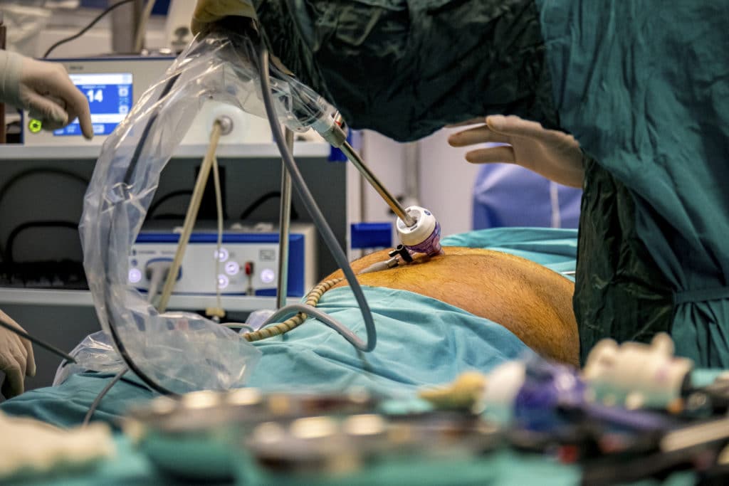 Surgeons Perform World’s First Combined Heart Pump And Pig Kidney