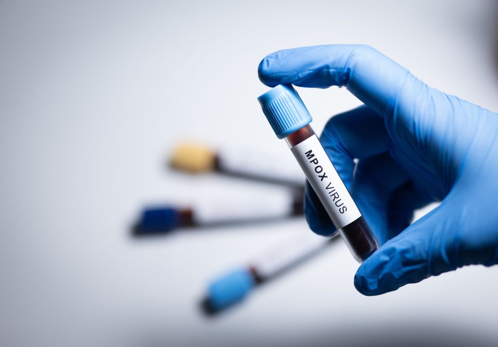 South Africa Confirms Rapid Rise In Mpox Cases In The Past Month